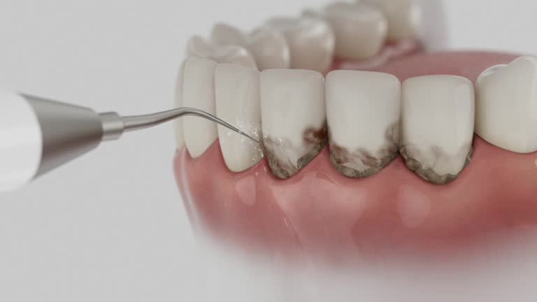 Reliable Teeth Cleaning And Checkup contractor in Carbon County County, WY by Dentist Open Now
